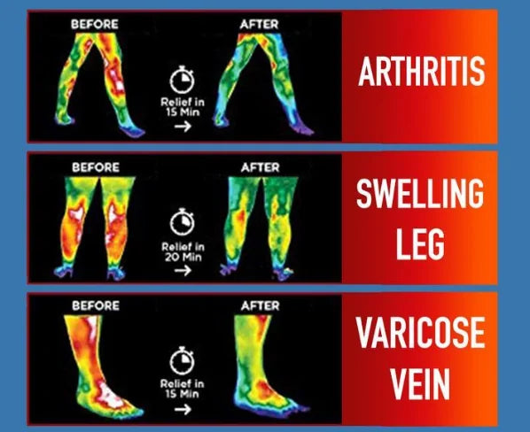 Nutripatch? Joint Arthritis Patch