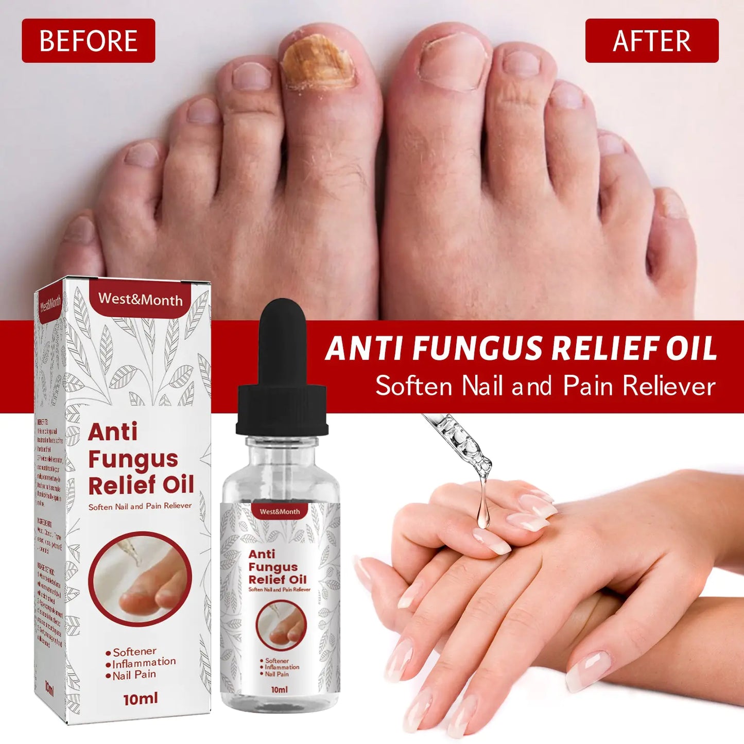 Oil Treatment Inflammation Nail